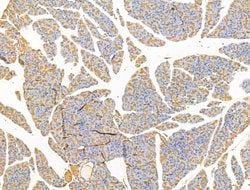 Invitrogen CLPB Polyclonal Antibody 100 &mu;L | Buy Online | Invitrogen&trade; | Fisher Scientific
