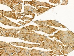 Invitrogen CNGA2 Polyclonal Antibody 100 &mu;L; Unconjugated:Antibodies,