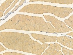 Invitrogen CNGA2 Polyclonal Antibody 100 &mu;L; Unconjugated:Antibodies,
