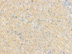 Invitrogen CNGA2 Polyclonal Antibody 100 &mu;L; Unconjugated:Antibodies,