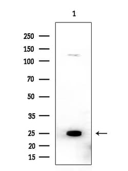 Invitrogen Cofilin 1/2 Polyclonal Antibody 100 &mu;L | Buy Online | Invitrogen&trade; | Fisher Scientific