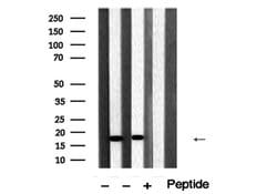 Invitrogen Cofilin 1/2 Polyclonal Antibody 100 μL; Unconjugated:Antibodies,