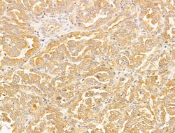 CERT Polyclonal Antibody:Antibodies, Polyclonal