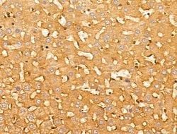 CERT Polyclonal Antibody:Antibodies, Polyclonal