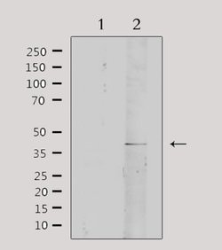 Invitrogen Collagen IV Polyclonal Antibody 100 &mu;L; Unconjugated:Antibodies,