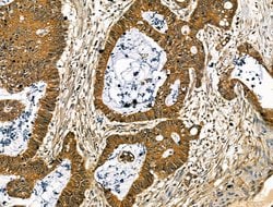 Invitrogen Collagen X Polyclonal Antibody 100 &mu;L; Unconjugated:Antibodies,
