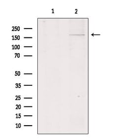 Invitrogen COL11A1 Polyclonal Antibody 100 μL; Unconjugated:Antibodies,