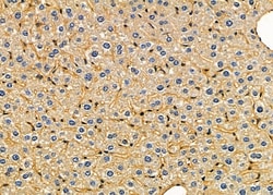 Invitrogen COPG Polyclonal Antibody 100 &mu;L; Unconjugated:Antibodies,