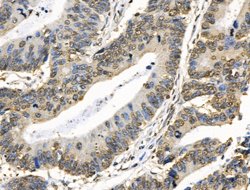 Invitrogen COPS2 Polyclonal Antibody 100 &mu;L | Buy Online | Invitrogen&trade; | Fisher Scientific