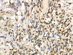 Invitrogen COPS2 Polyclonal Antibody 100 &mu;L | Buy Online | Invitrogen&trade; | Fisher Scientific