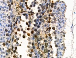 Invitrogen COPS2 Polyclonal Antibody 100 &mu;L | Buy Online | Invitrogen&trade; | Fisher Scientific