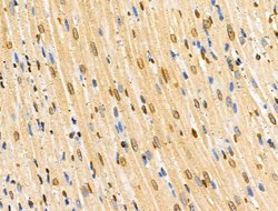 Invitrogen COPS2 Polyclonal Antibody 100 &mu;L | Buy Online | Invitrogen&trade; | Fisher Scientific