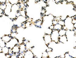 Invitrogen COPS2 Polyclonal Antibody 100 &mu;L | Buy Online | Invitrogen&trade; | Fisher Scientific