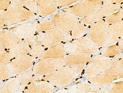 Invitrogen COPS2 Polyclonal Antibody 100 &mu;L | Buy Online | Invitrogen&trade; | Fisher Scientific