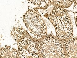 Invitrogen RCOR1 Polyclonal Antibody 100 &mu;L; Unconjugated:Antibodies,