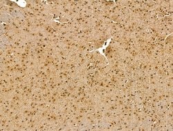 Invitrogen RCOR1 Polyclonal Antibody 100 &mu;L; Unconjugated:Antibodies,