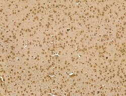Invitrogen RCOR1 Polyclonal Antibody 100 &mu;L; Unconjugated:Antibodies,