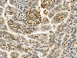 Invitrogen RCOR1 Polyclonal Antibody 100 &mu;L; Unconjugated:Antibodies,