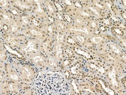 Invitrogen RCOR1 Polyclonal Antibody 100 &mu;L; Unconjugated:Antibodies,