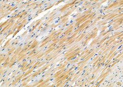 Invitrogen CRABP2 Polyclonal Antibody 100 &mu;L; Unconjugated:Antibodies,