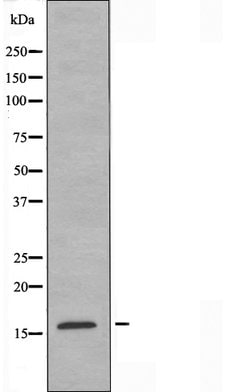 Invitrogen CRABP2 Polyclonal Antibody 100 &mu;L; Unconjugated:Antibodies,