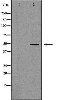 Invitrogen CD116 Polyclonal Antibody 100 μL; Unconjugated:Antibodies,