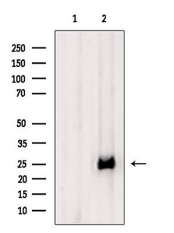 Invitrogen CTLA-4 Polyclonal Antibody 100 &mu;L | Buy Online | Invitrogen&trade; | Fisher Scientific