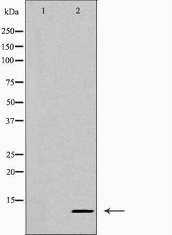 Invitrogen CXCL10 Polyclonal Antibody 100 &mu;L; Unconjugated:Antibodies,
