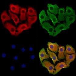 Invitrogen CXCL16 Polyclonal Antibody 100 &mu;L | Buy Online | Invitrogen&trade; | Fisher Scientific
