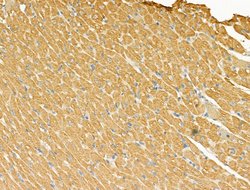 Invitrogen CXCL16 Polyclonal Antibody 100 &mu;L | Buy Online | Invitrogen&trade; | Fisher Scientific