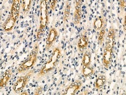 Invitrogen Cytochrome B5 Polyclonal Antibody 100 &mu;L; Unconjugated:Antibodies,