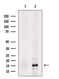 Invitrogen Cytochrome B5 Polyclonal Antibody 100 &mu;L; Unconjugated:Antibodies,