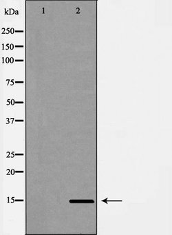 Invitrogen™ Cytochrome B5 Polyclonal Antibody