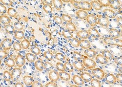 Invitrogen COX6A1 Polyclonal Antibody 100 &mu;L; Unconjugated:Antibodies,