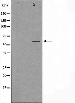 Invitrogen CYP24A1 Polyclonal Antibody 100 &mu;L; Unconjugated:Antibodies,