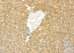 Invitrogen CYP2D6 Polyclonal Antibody 100 &mu;L; Unconjugated:Antibodies,