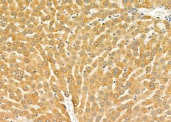 Invitrogen CYP2D6 Polyclonal Antibody 100 &mu;L; Unconjugated:Antibodies,