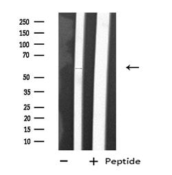 Invitrogen CYP2D6 Polyclonal Antibody 100 &mu;L; Unconjugated:Antibodies,