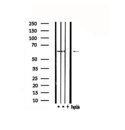 Invitrogen CYP2D6 Polyclonal Antibody 100 &mu;L; Unconjugated:Antibodies,