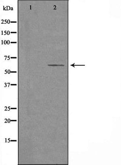 Invitrogen CYP2U1 Polyclonal Antibody 100 &mu;L | Buy Online | Invitrogen&trade; | Fisher Scientific