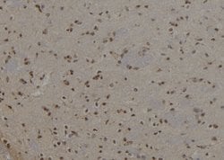 Invitrogen Cytokeratin 6A Polyclonal Antibody 100 &mu;L; Unconjugated:Antibodies,