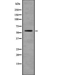 Invitrogen Cytokeratin 6A Polyclonal Antibody 100 &mu;L; Unconjugated:Antibodies,
