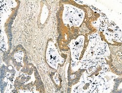 Invitrogen DYNC1I1 Polyclonal Antibody 100 &mu;L; Unconjugated:Antibodies,