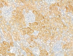 Invitrogen DYNC1I1 Polyclonal Antibody 100 &mu;L; Unconjugated:Antibodies,
