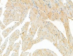 Invitrogen DYNC1I1 Polyclonal Antibody 100 &mu;L; Unconjugated:Antibodies,