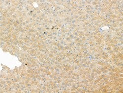 Invitrogen DYNC1I1 Polyclonal Antibody 100 &mu;L; Unconjugated:Antibodies,