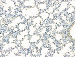 Invitrogen DYNC1I1 Polyclonal Antibody 100 &mu;L; Unconjugated:Antibodies,