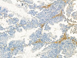 Invitrogen DYNC1I1 Polyclonal Antibody 100 &mu;L; Unconjugated:Antibodies,