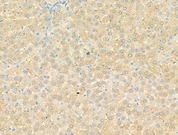 Invitrogen DYNC1I1 Polyclonal Antibody 100 &mu;L; Unconjugated:Antibodies,