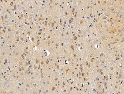 Invitrogen DAGLA Polyclonal Antibody 100 &mu;L; Unconjugated:Antibodies,